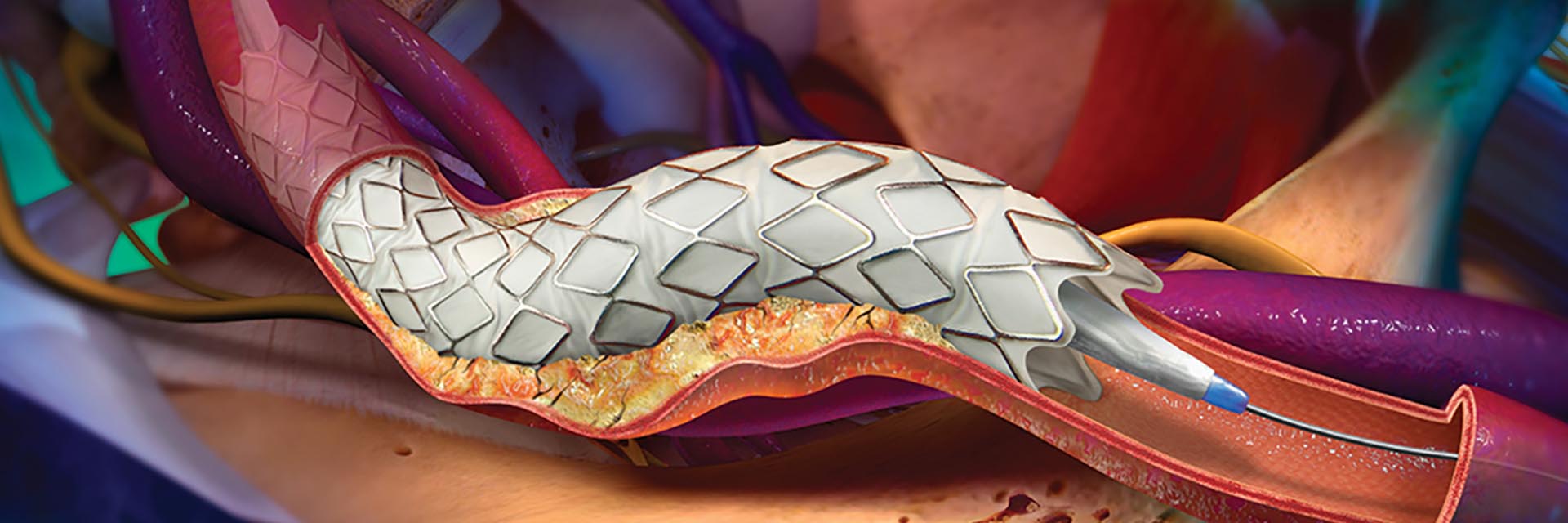 ΚΙΡΣΟΙ Slide-3